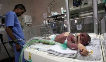 Zwischen den Walzen: Gazas Kinder sterben durch die Belagerung und den Mangel an medizinischer Versorgung