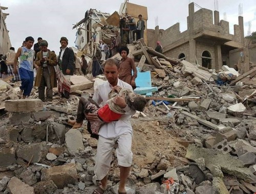 Yemen Savaşında 10 Bin Çocuk Öldü Ya da Sakat Kaldı, Daha Ne Zamana Kadar Çocuklar Geçici İstatistiklerde Kalacak?